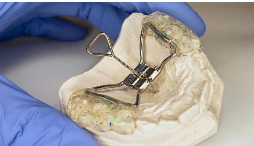 patient with lingual braces